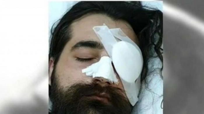 «Να βρεθούν οι αστυνομικοί που με τραυμάτισαν» – Ο οπαδός που τυφλώθηκε στο ΟΑΚΑ προαναγγέλλει μηνύσεις και αγωγές | panathinaikos24.gr «Να βρεθούν οι αστυνομικοί που με τραυμάτισαν» – Ο οπαδός που τυφλώθηκε στο ΟΑΚΑ προαναγγέλλει μηνύσεις και αγωγές | panathinaikos24.gr