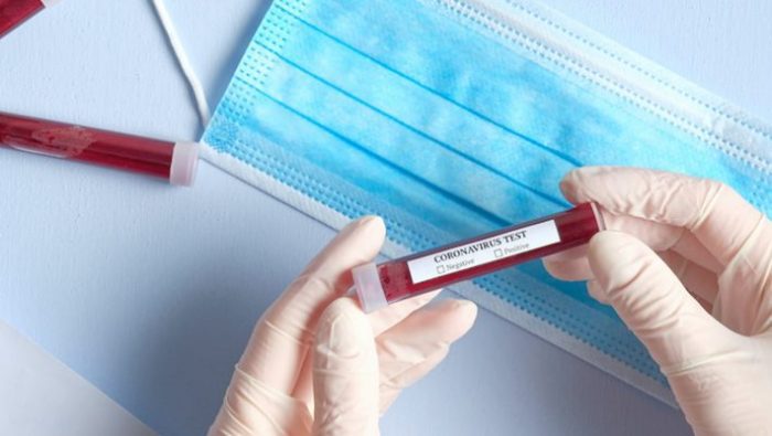 Κατακκόκινη: Η περιοχή της Ελλάδας με 50% των τεστ θετικά στον κορωνοϊό | panathinaikos24.gr Κατακκόκινη: Η περιοχή της Ελλάδας με 50% των τεστ θετικά στον κορωνοϊό | panathinaikos24.gr